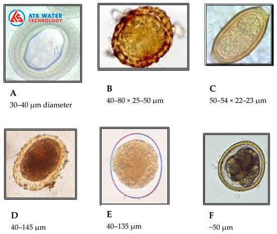 Ảnh vi điện tử của trứng Taenia spp. (A), trứng giun đũa (B), trứng Trichuris trichiura (C), vỏ hạt cây (cấu trúc bao bọc trứng giun sán hoặc các tác nhân gây bệnh) (D), trứng côn trùng hoặc bào tử (E), trứng Toxocara cati (F)